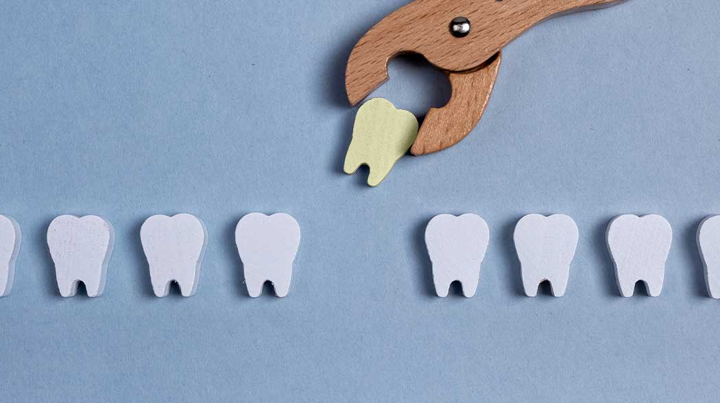 Emergency Abscess Tooth Removal and Extraction in Tacoma, WA at Tacoma Advanced Dental