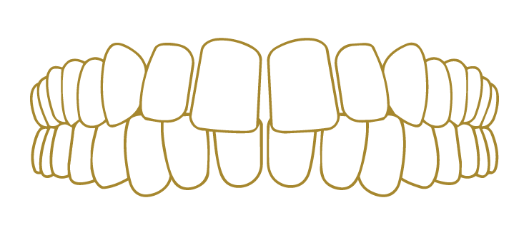 Teeth Spacing Smile Gallery