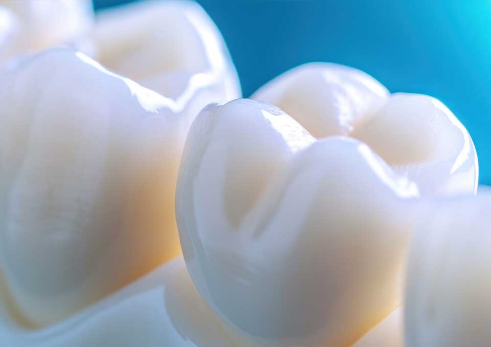 Same-Day Ceramic Dental Crowns in Tacoma, WA